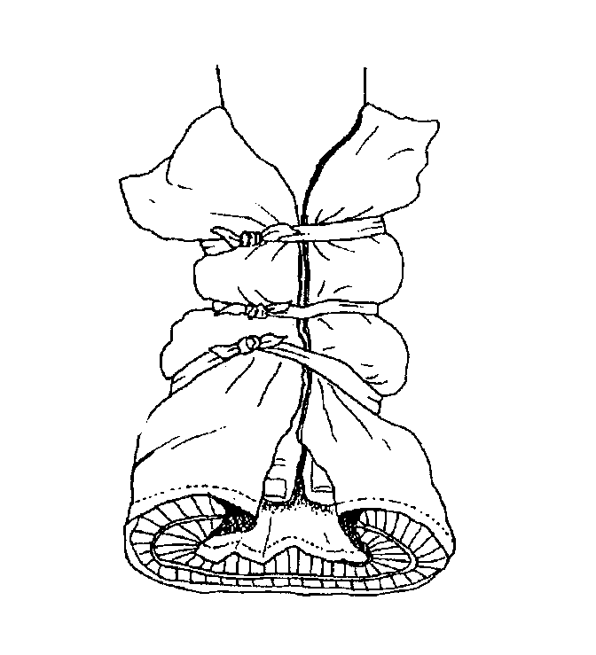 “towel splint and pillow splint”