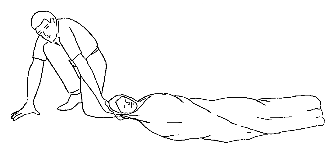 “blanket drag technique”